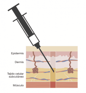 Inyección en tejido celular subcutáneo